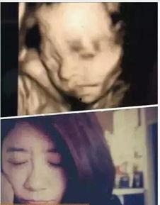 明星宝宝四维照片对比,明星宝宝成长轨迹大对比